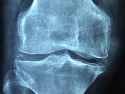 RHEUMA FREI ENERGIE 999 - Vorsorge&Heilung